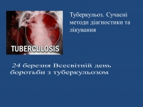 Презентація на тему «Туберкульоз. Сучасні методи діагностики та лікування»