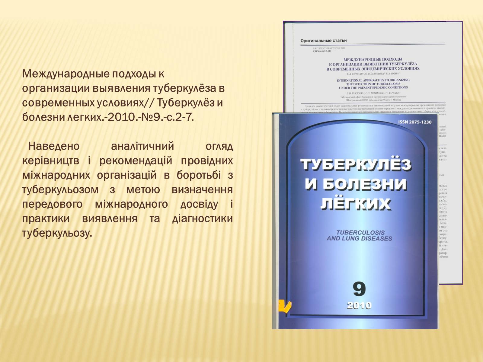 Презентація на тему «Туберкульоз. Сучасні методи діагностики та лікування» - Слайд #14