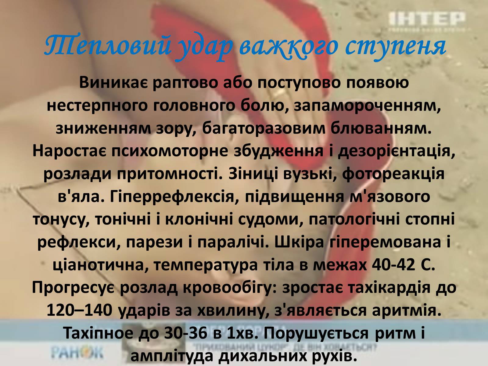 Презентація на тему «Тепловий і сонячний удар» (варіант 2) - Слайд #5