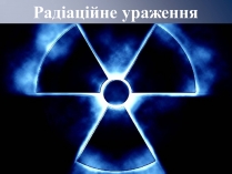 Презентація на тему «Радіаційне ураження» (варіант 1)