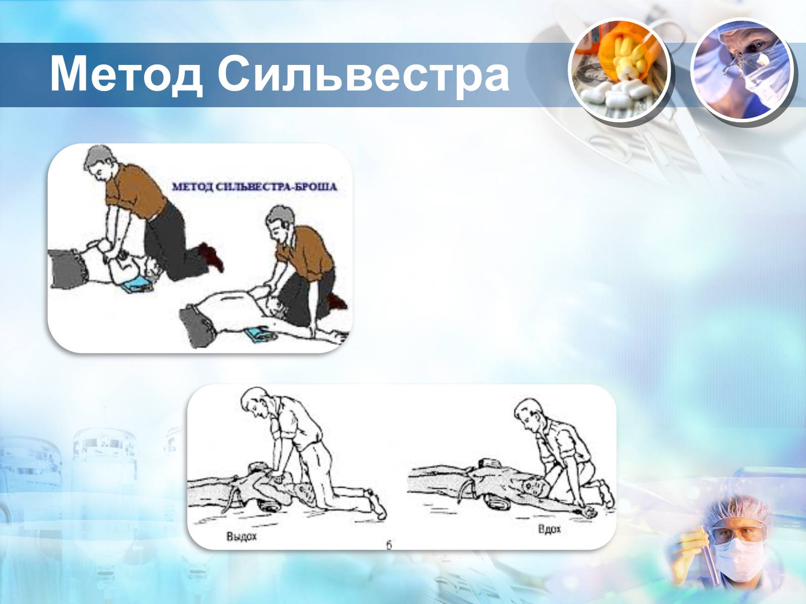 Презентація на тему «Методика проведення штучного дихання і закритого масажу серця» - Слайд #6