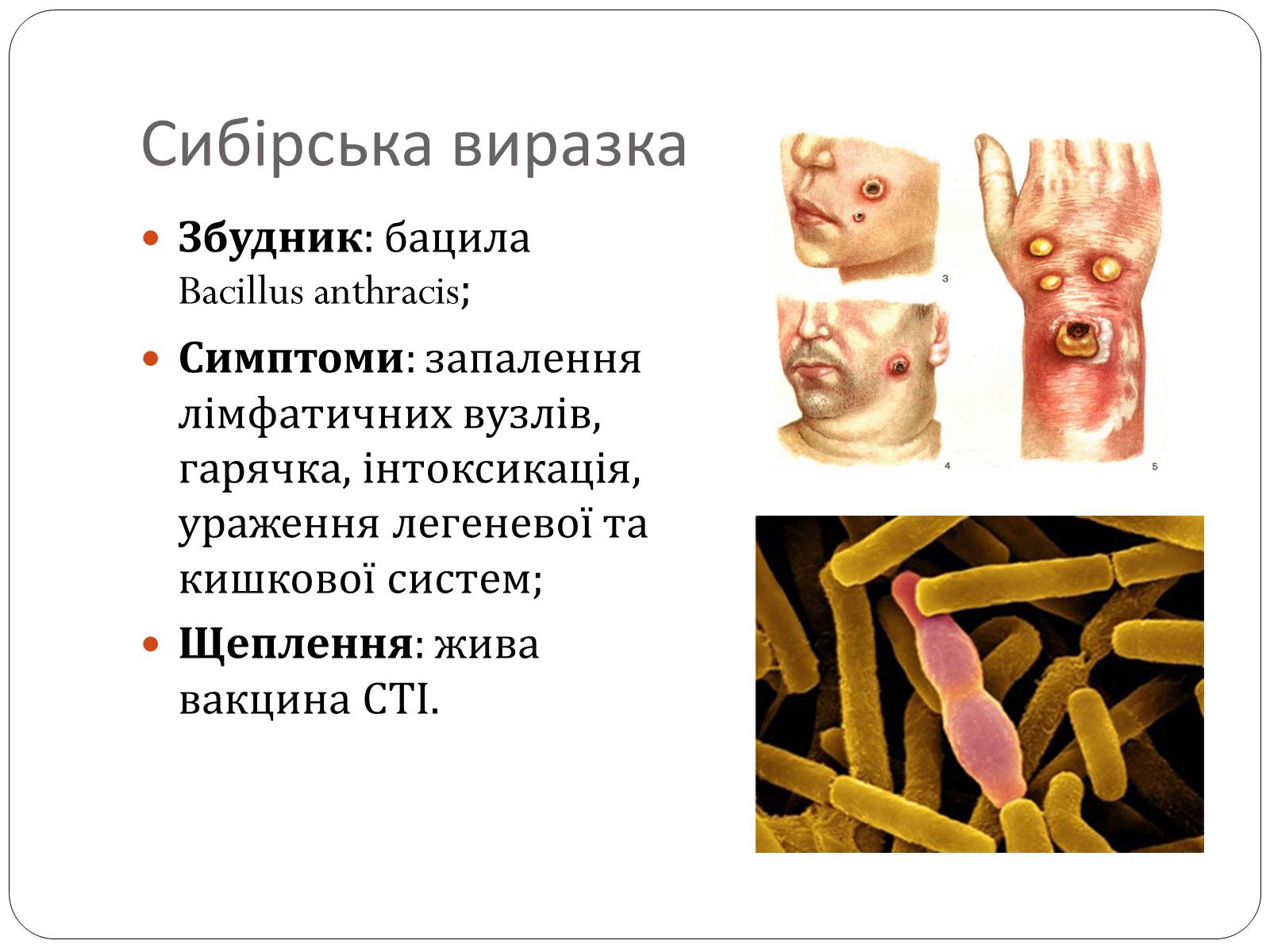 Презентація на тему «Інфекційні захворювання» (варіант 3) - Слайд #11