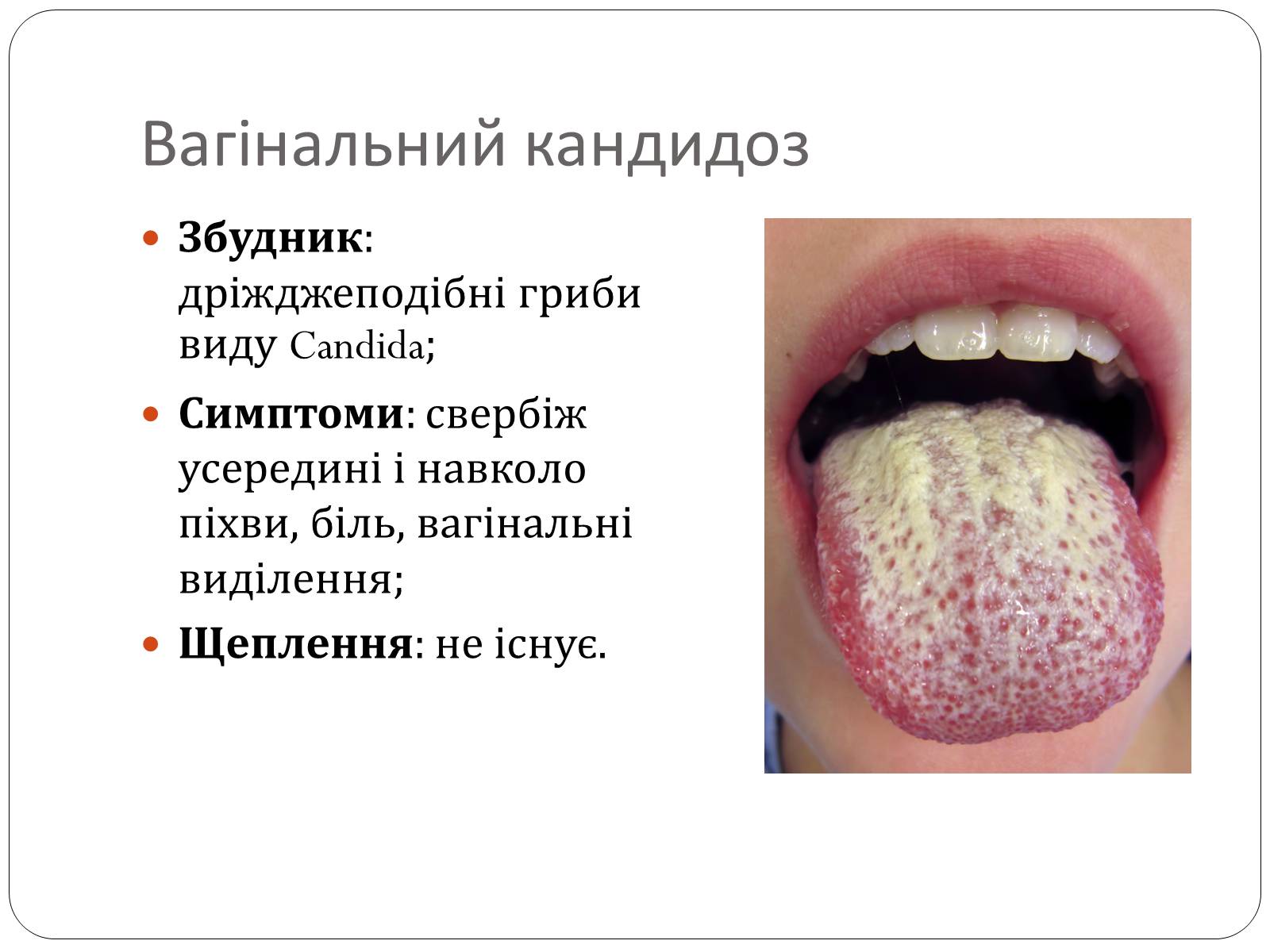 Презентація на тему «Інфекційні захворювання» (варіант 3) - Слайд #8