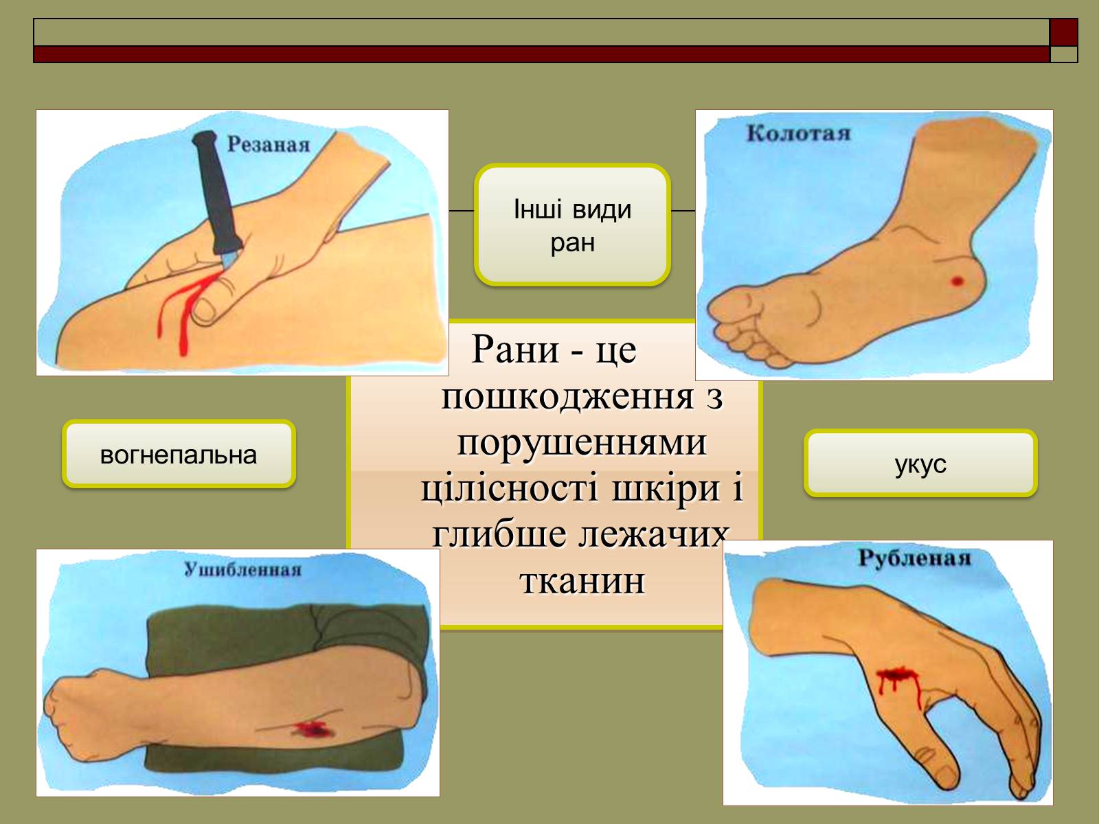 Презентація на тему «Перша медична допомога» (варіант 2) - Слайд #7