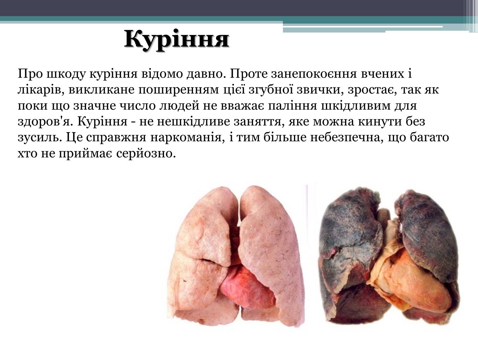 Презентація на тему «Вплив куріння, алкоголю та наркотиків на здоров&#8217;я людини» - Слайд #3