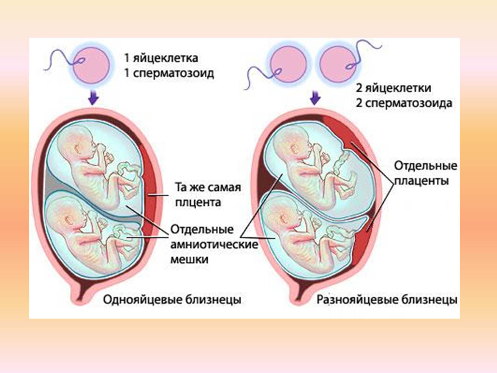 Презентація на тему «Близнецы» - Слайд #6