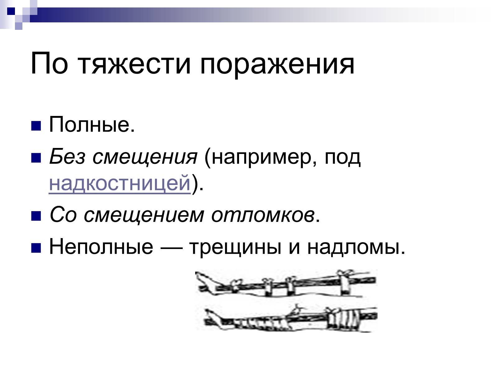 Презентація на тему «Первая помощь при переломах» (варіант 2) - Слайд #5