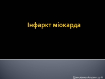 Презентація на тему «Інфаркт міокарда» (варіант 1)