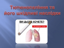 Презентація на тему «Тютюнопаління» (варіант 3)