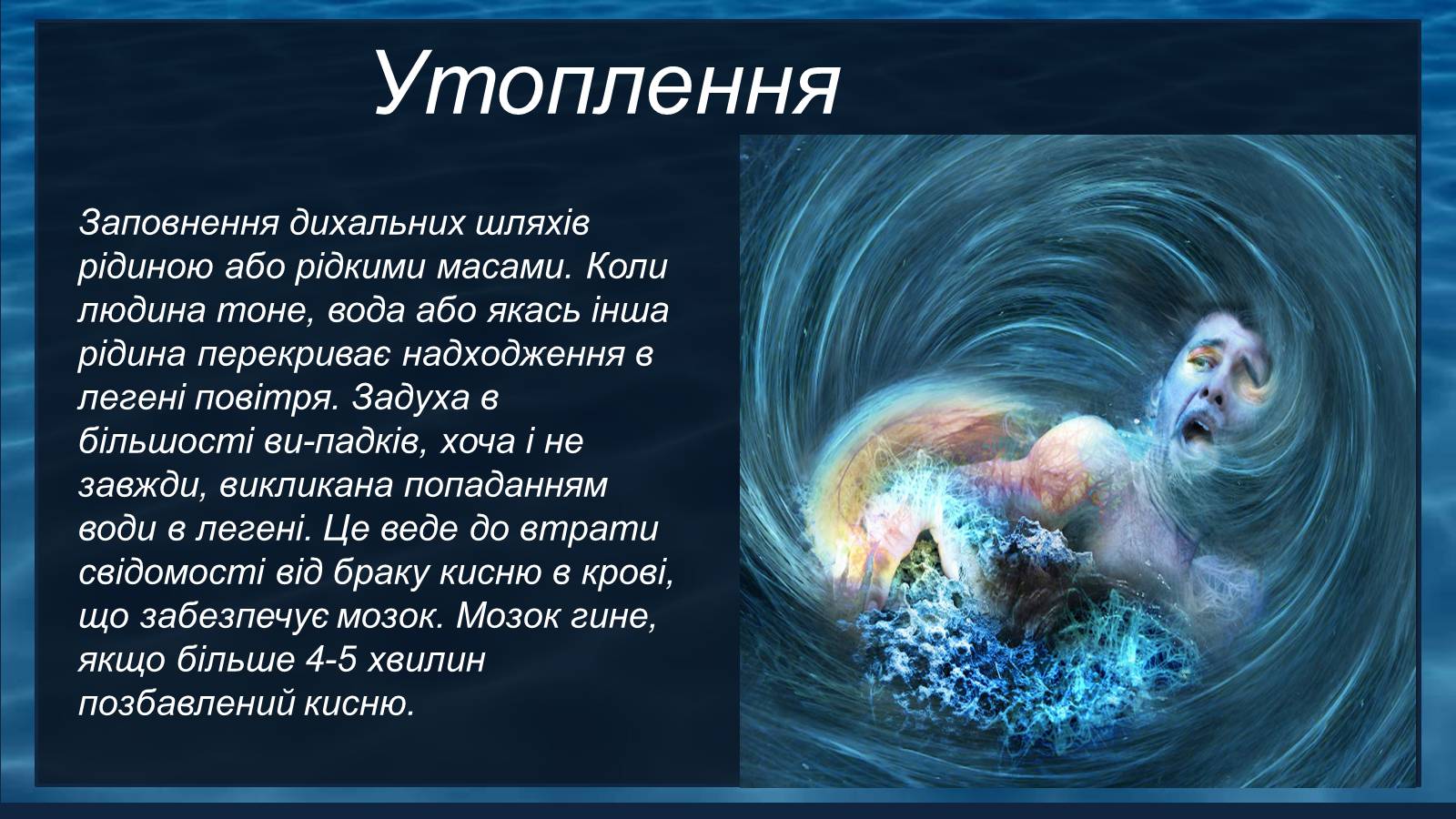 Презентація на тему «Надання першої допомоги при утопленні» - Слайд #2