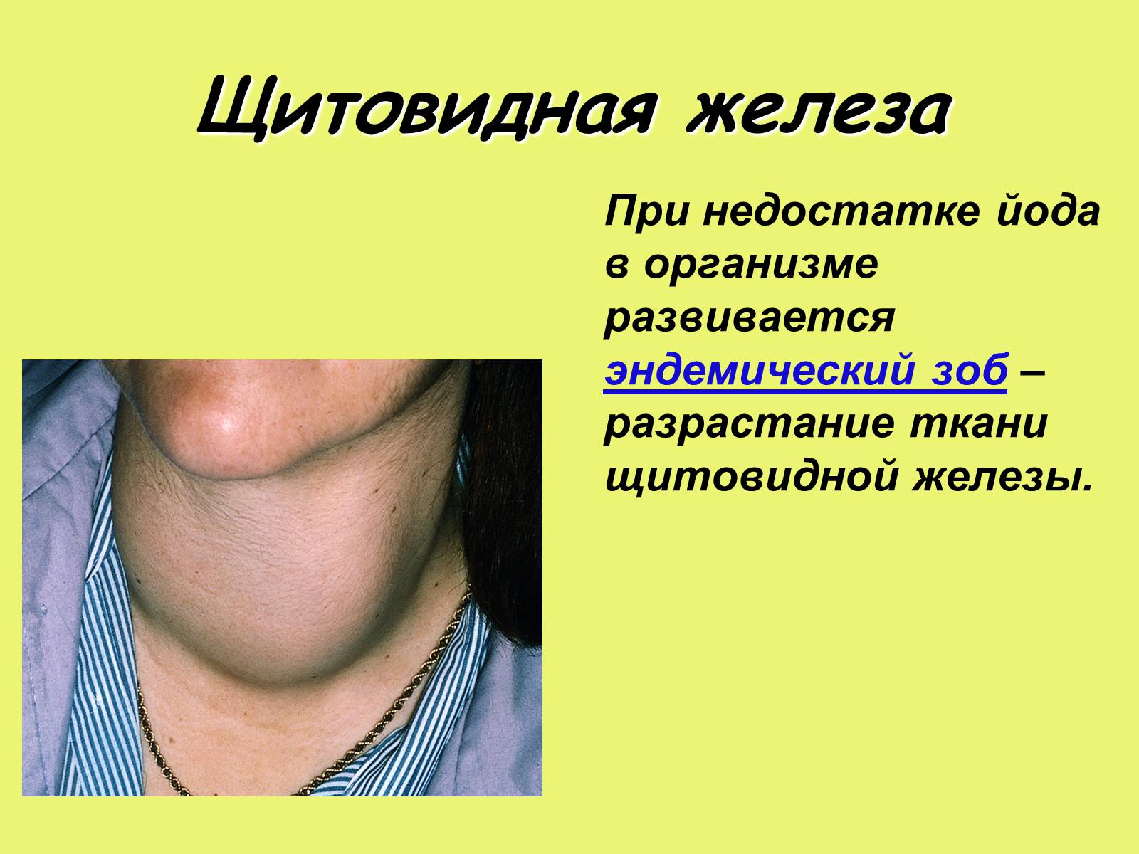 Презентація на тему «Эндокринные железы» - Слайд #14