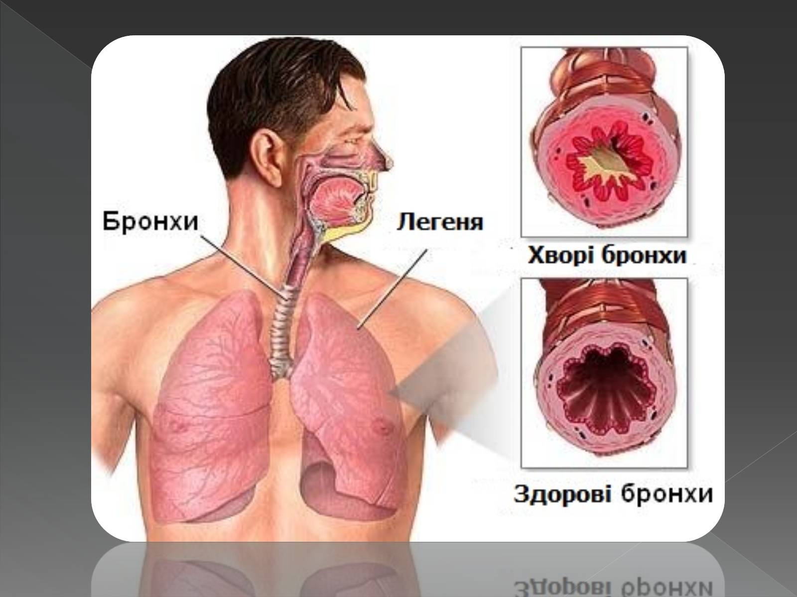 Презентація на тему «Види професійних захворювань органів дихання» - Слайд #9