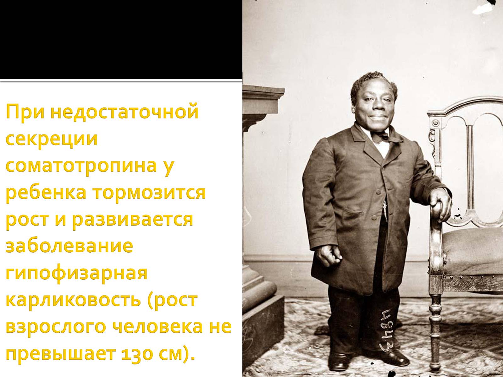 Презентація на тему «Железы внутренней секреции» (варіант 1) - Слайд #16