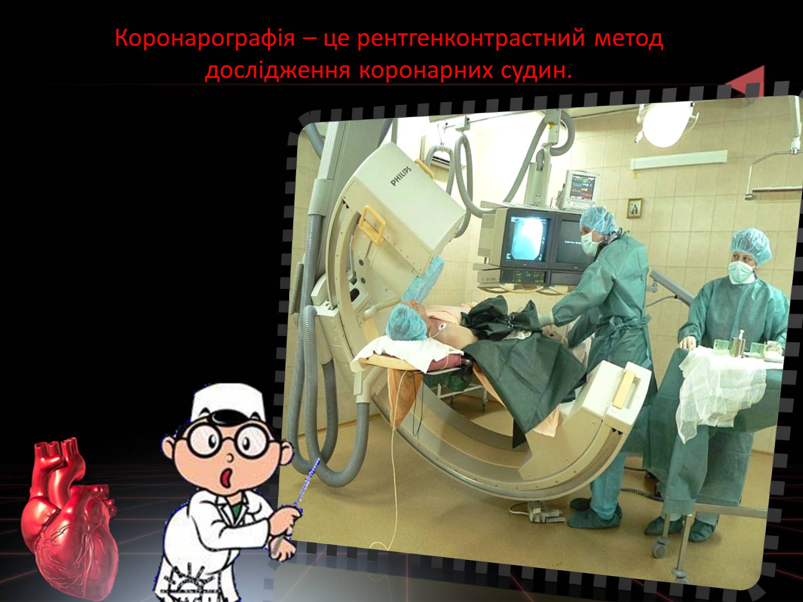 Презентація на тему «Методи відновлення кровообігу в уражених атеросклерозом коронарних артеріях при ішемічній хворобі серця» - Слайд #13