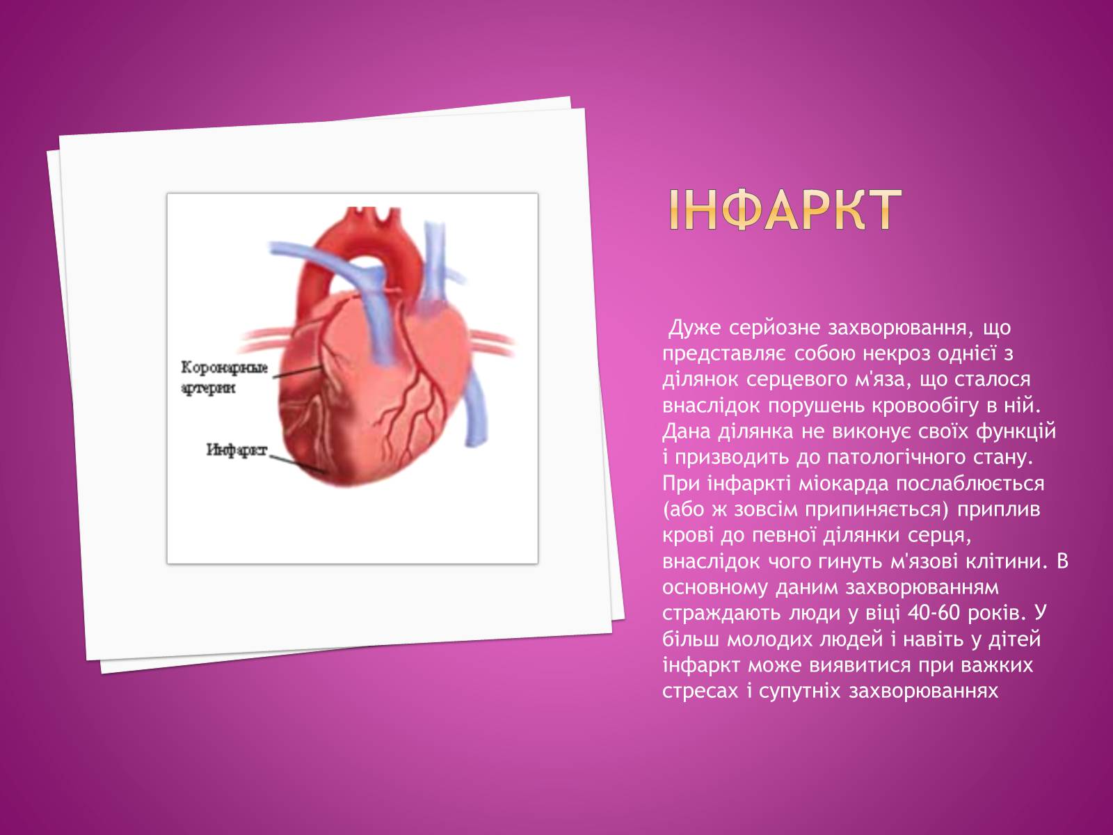 Презентація на тему «Догляд за хворими після інфаркту» - Слайд #2