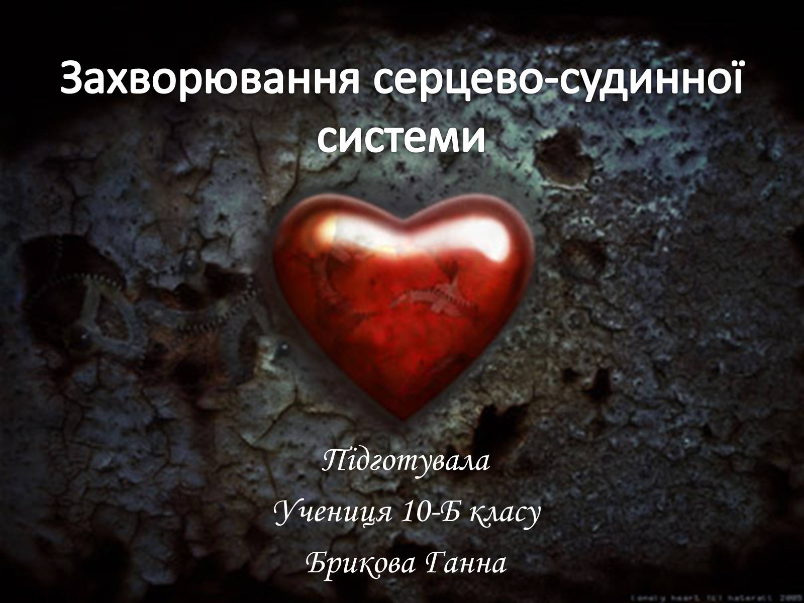 Презентація на тему «Захворювання серцево-судинної системи» (варіант 2) - Слайд #1