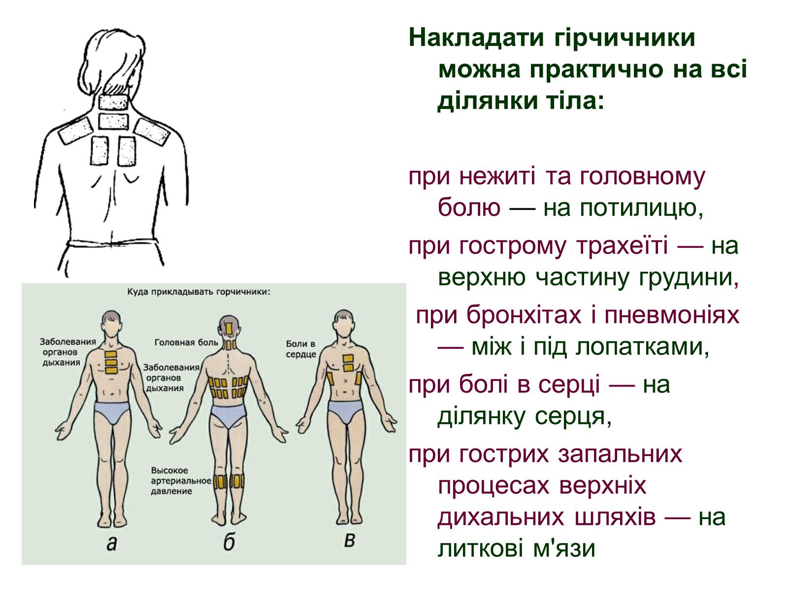 Презентація на тему «Допоміжні засоби лікування» - Слайд #5