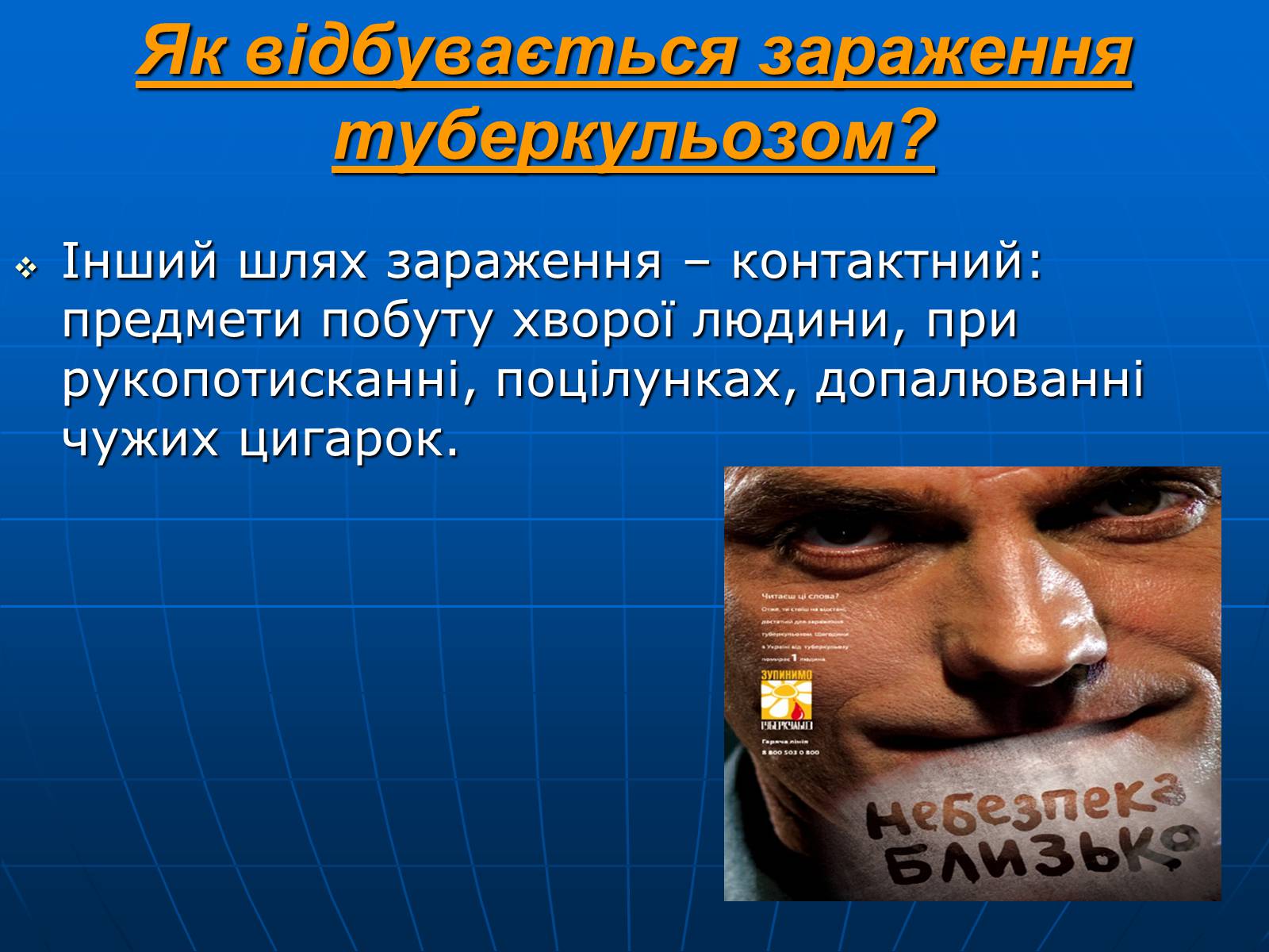 Презентація на тему «Проблема туберкульозу в Україні» - Слайд #7