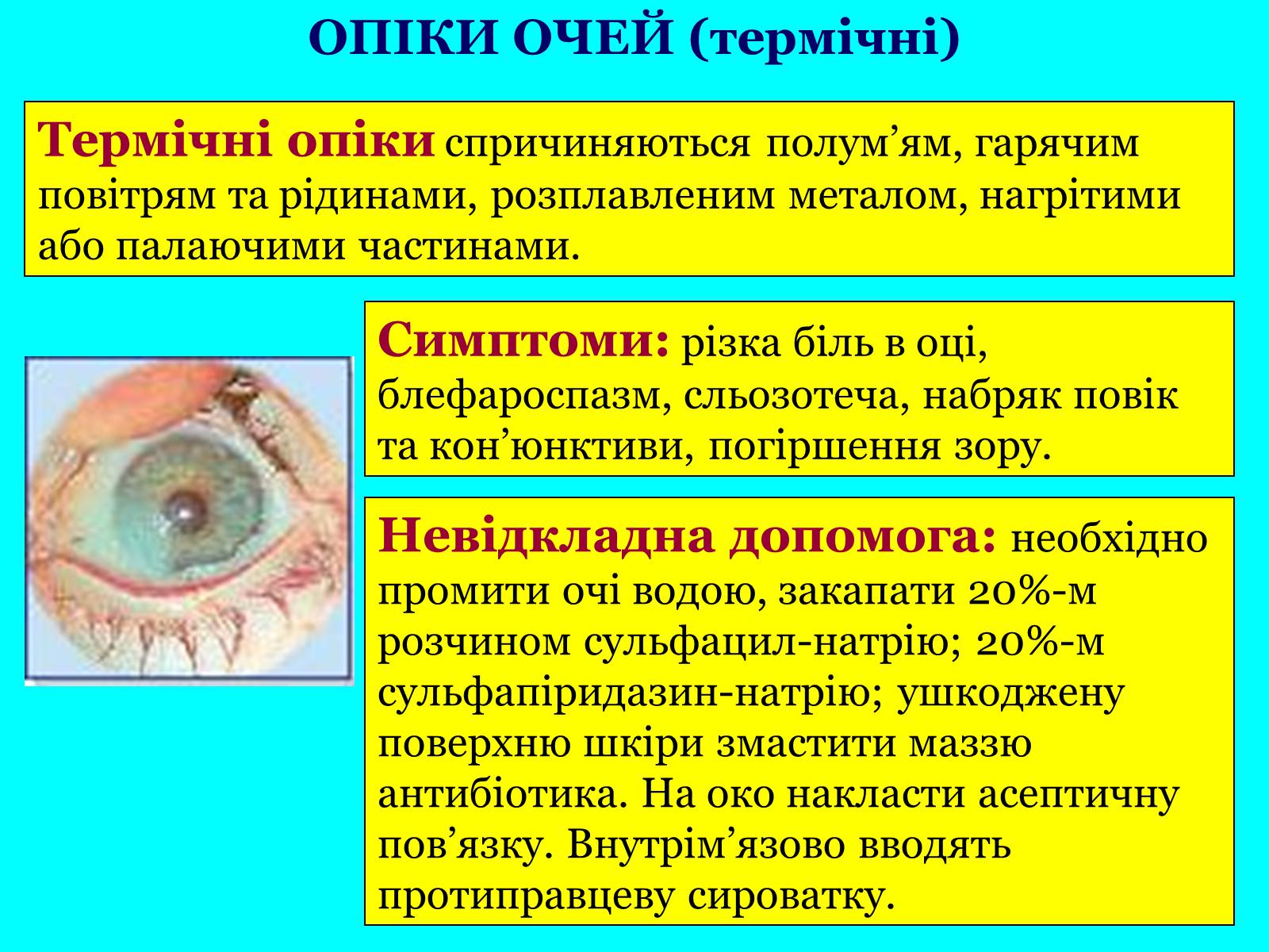 Презентація на тему «Опіки: види, причини, надання першої допомоги» - Слайд #18