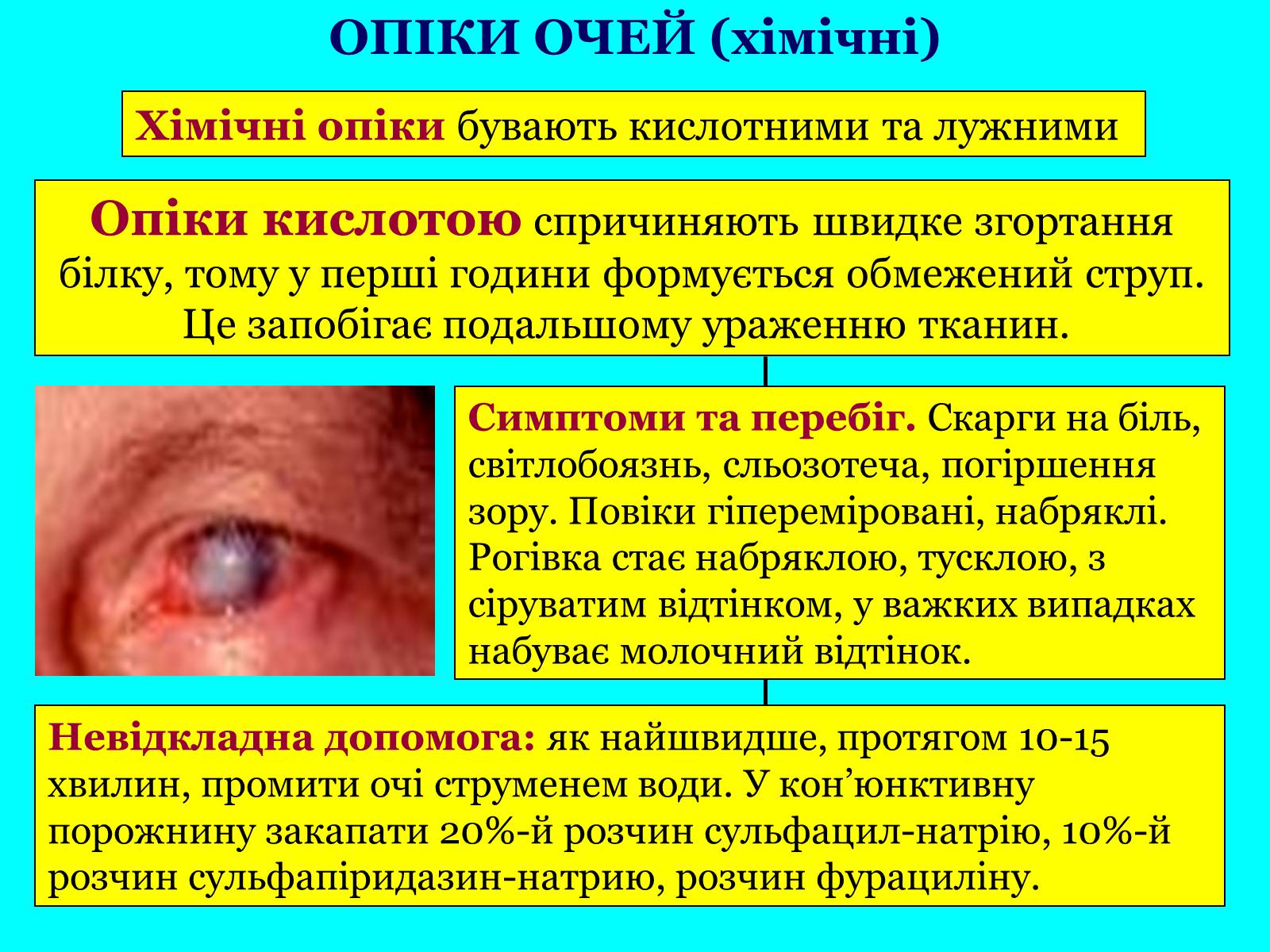 Презентація на тему «Опіки: види, причини, надання першої допомоги» - Слайд #19