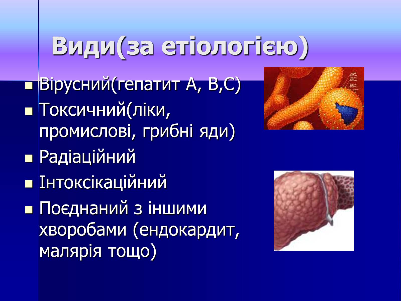 Презентація на тему «Гепатит» (варіант 1) - Слайд #4