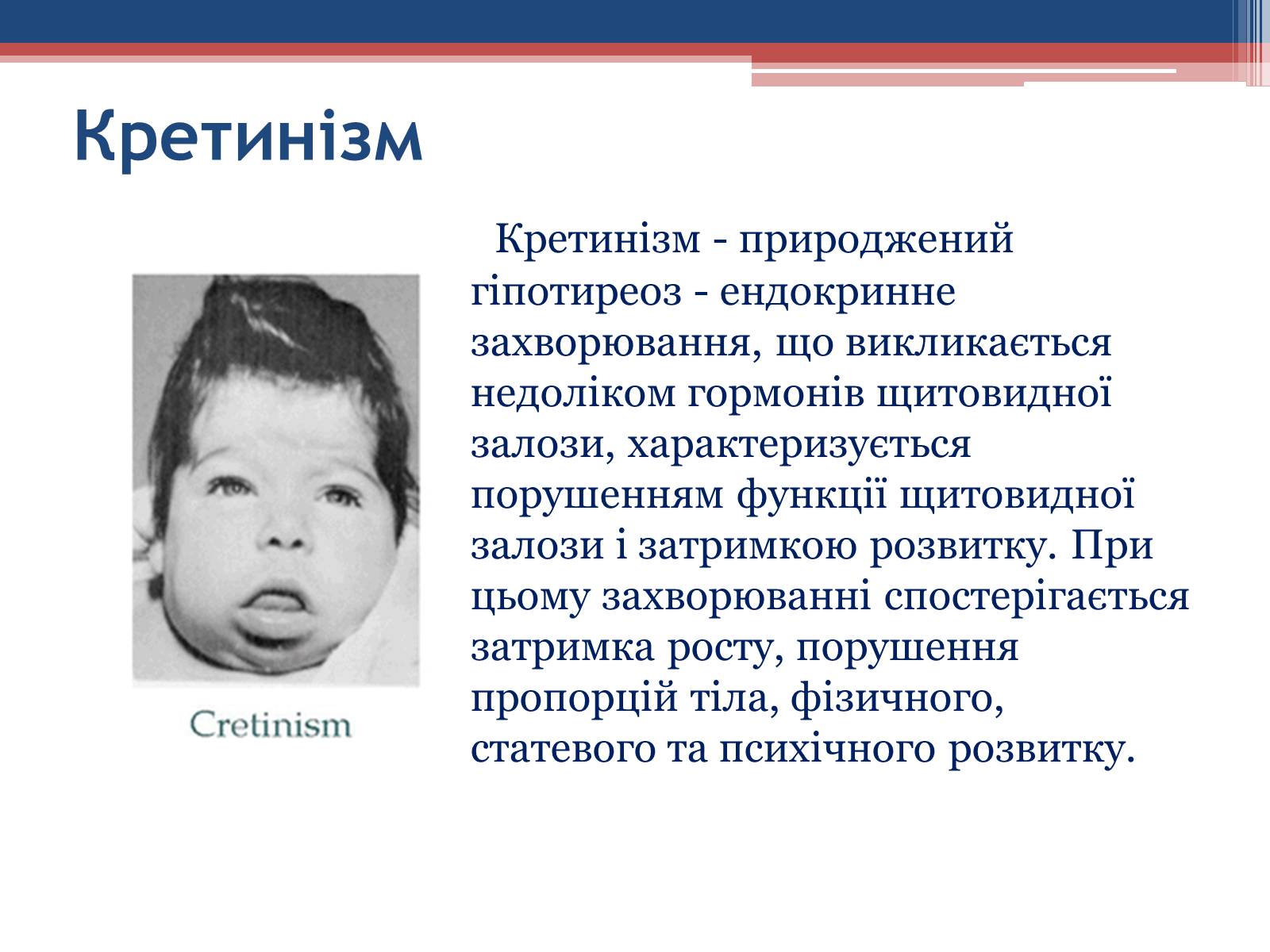 Презентація на тему «Порушення гормональних функцій ендокринних залоз» - Слайд #10