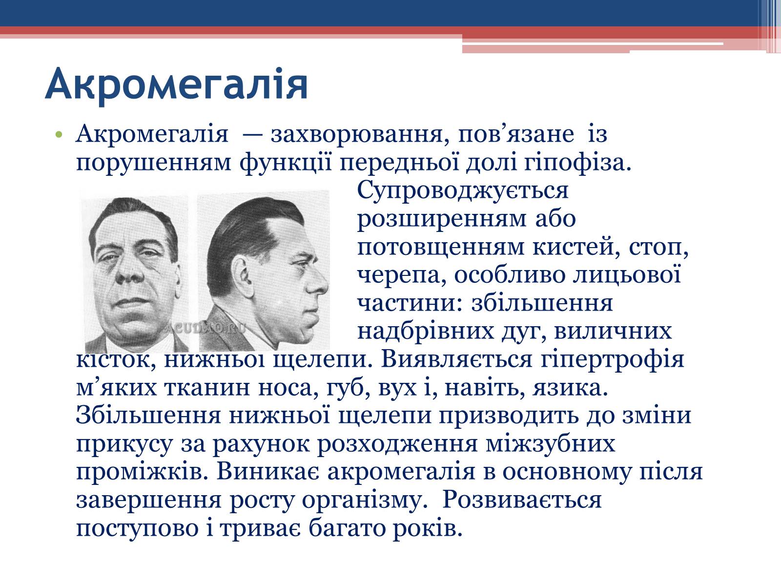 Презентація на тему «Порушення гормональних функцій ендокринних залоз» - Слайд #6