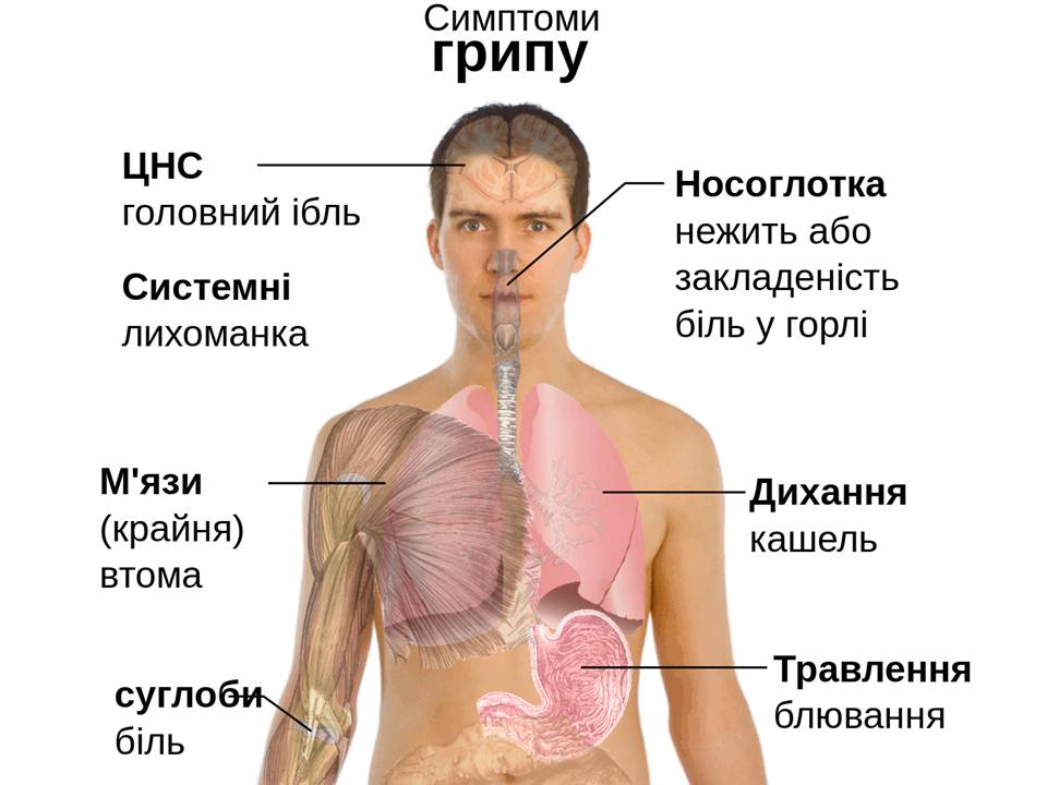 Презентація на тему «Грип» (варіант 6) - Слайд #3