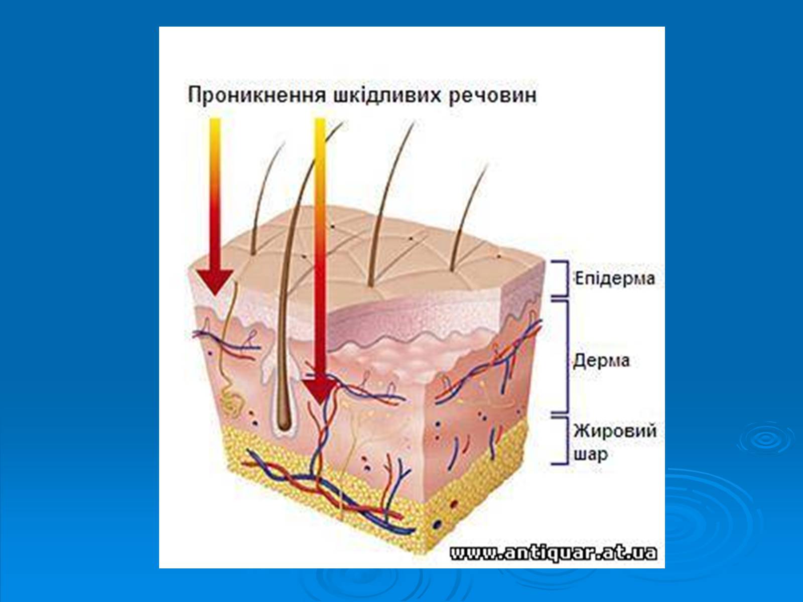 Презентація на тему «Обмороженя» - Слайд #4