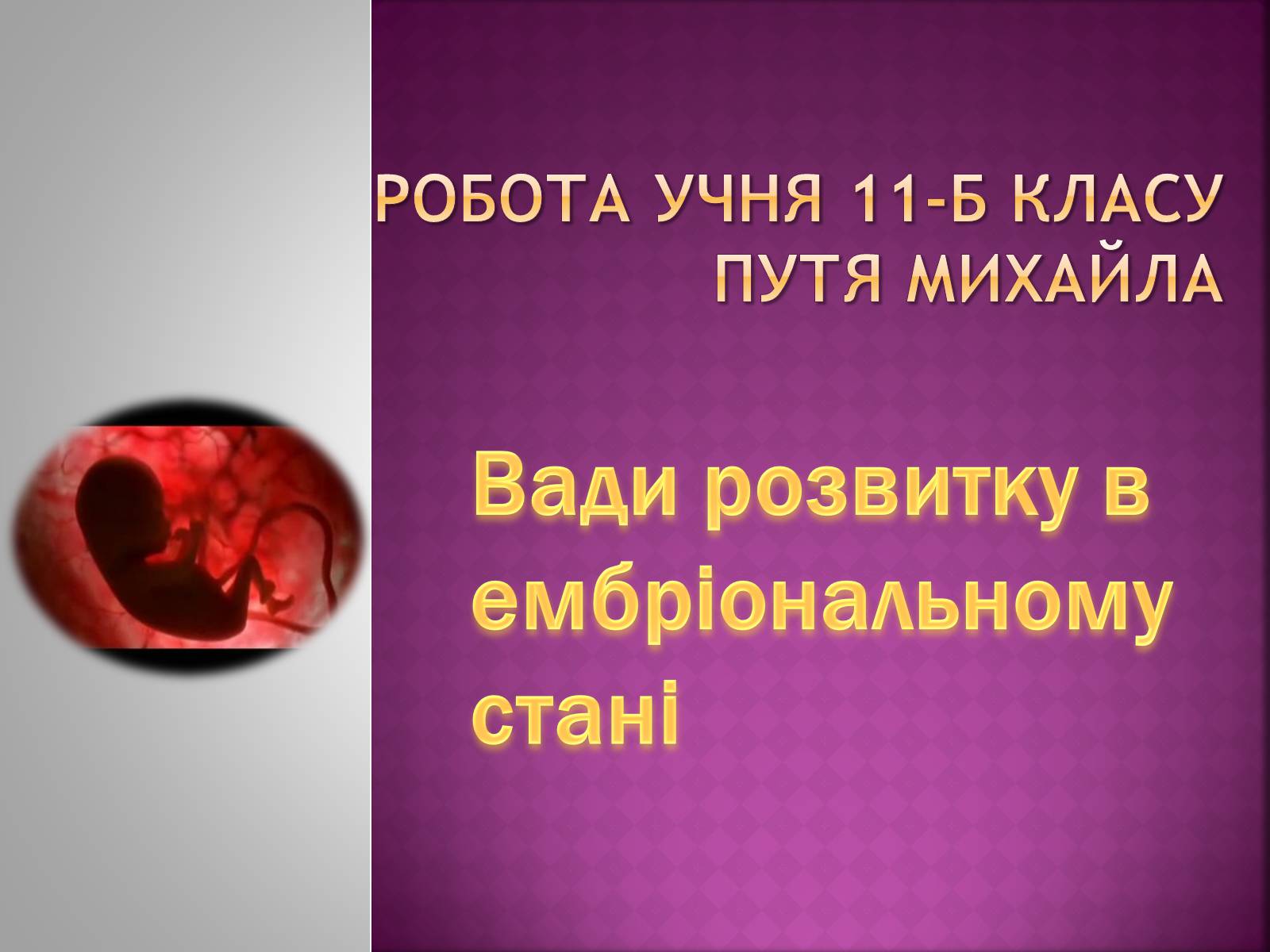 Презентація на тему «Вади розвитку в ембріональному стані» - Слайд #1