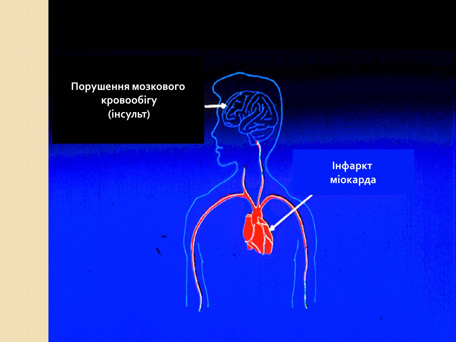 Презентація на тему «Палити чи не палити?» - Слайд #8