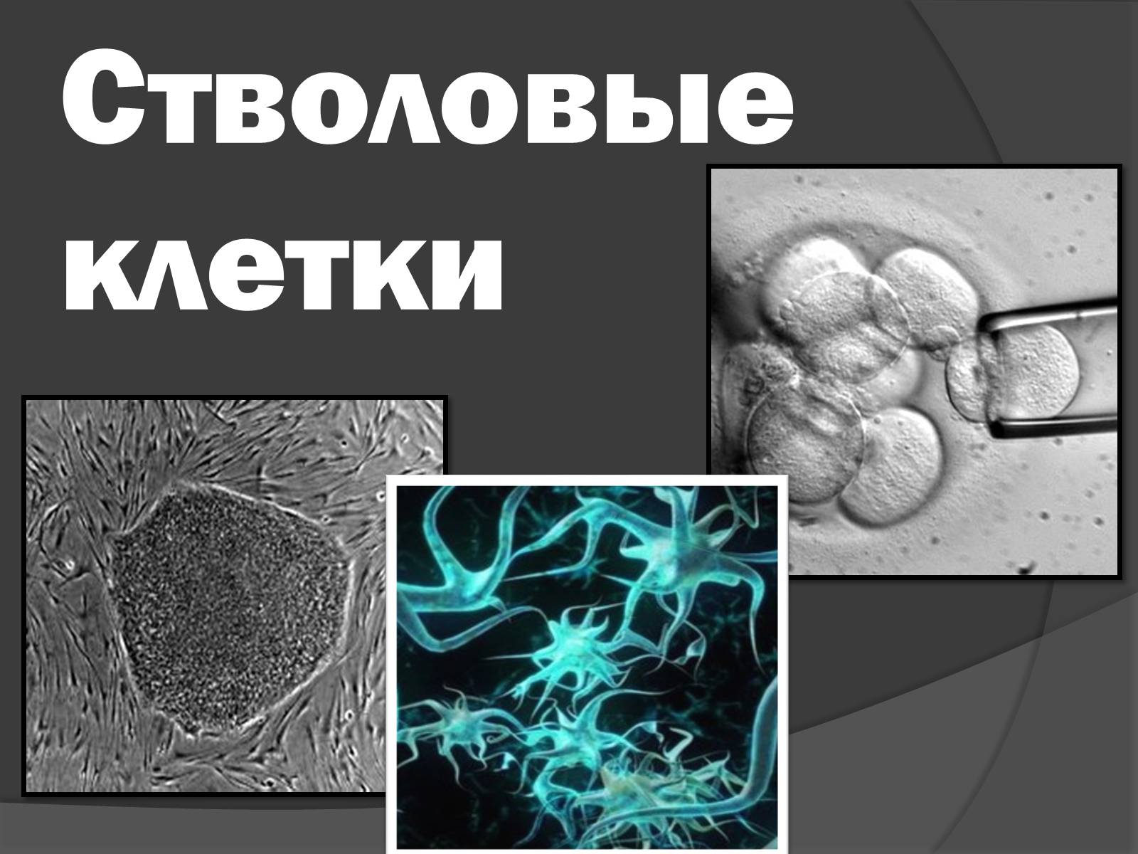 Что такое стволовые клетки простыми. Стволовые клетки. Стромальные стволовые клетки. Стволовые клетки презентация. Эмбриональные стволовые клетки.