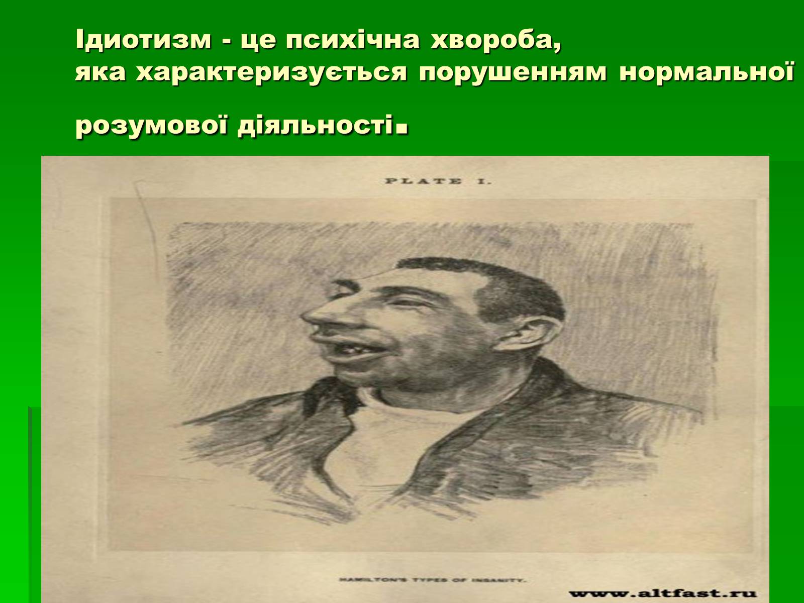 Презентація на тему «Захворювання залоз внутрішньої секреції» - Слайд #12