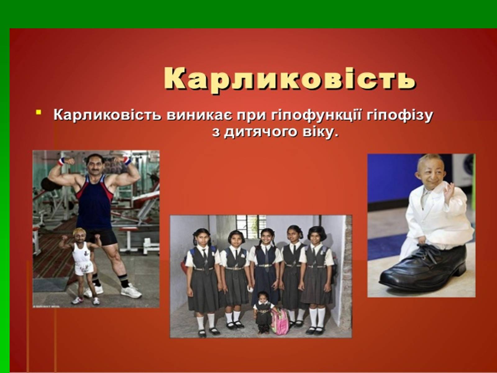 Презентація на тему «Захворювання залоз внутрішньої секреції» - Слайд #3