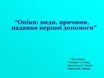 Презентація на тему «Опіки» (варіант 5)