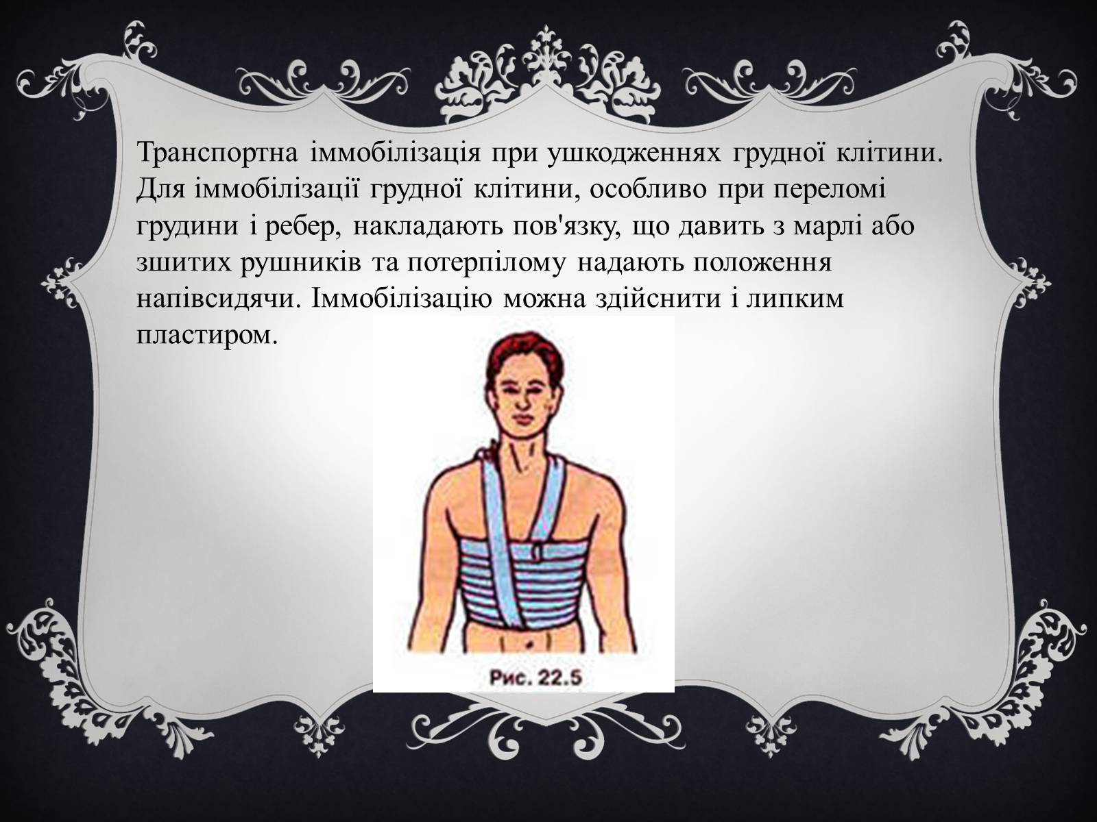 Презентація на тему «Іммобілізація пошкодженої ділянки тіла людини» - Слайд #8