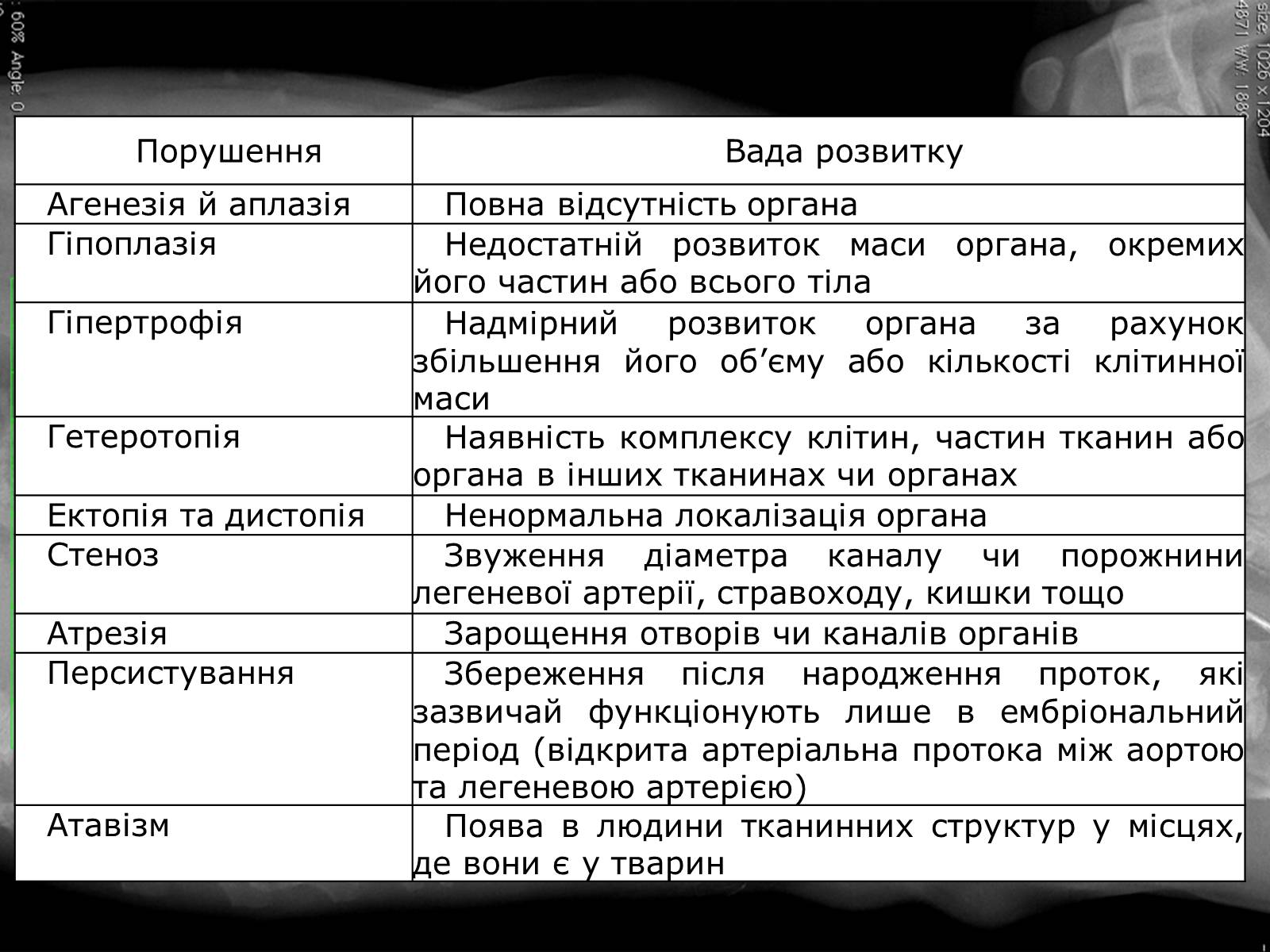 Презентація на тему «Діагностування вад розвитку людини» (варіант 2) - Слайд #4