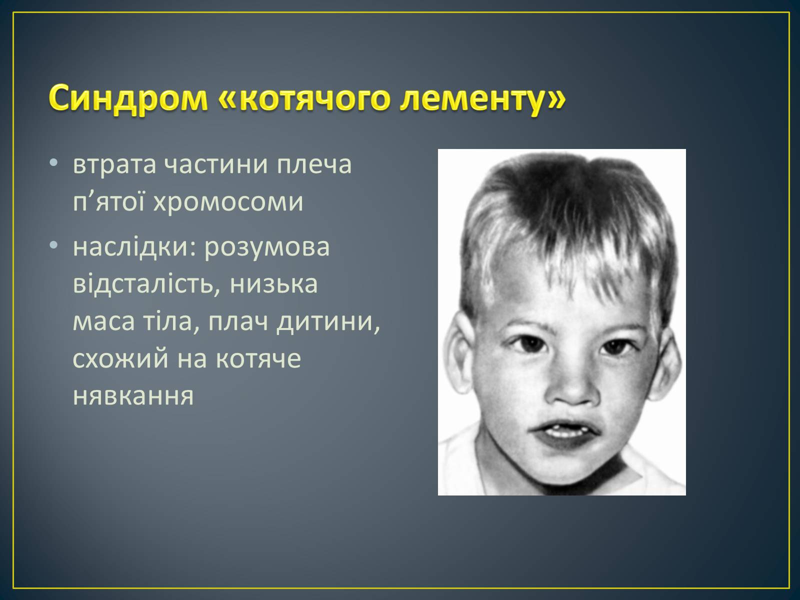 Презентація на тему «Типи генетичних хвороб людини» (варіант 2) - Слайд #16