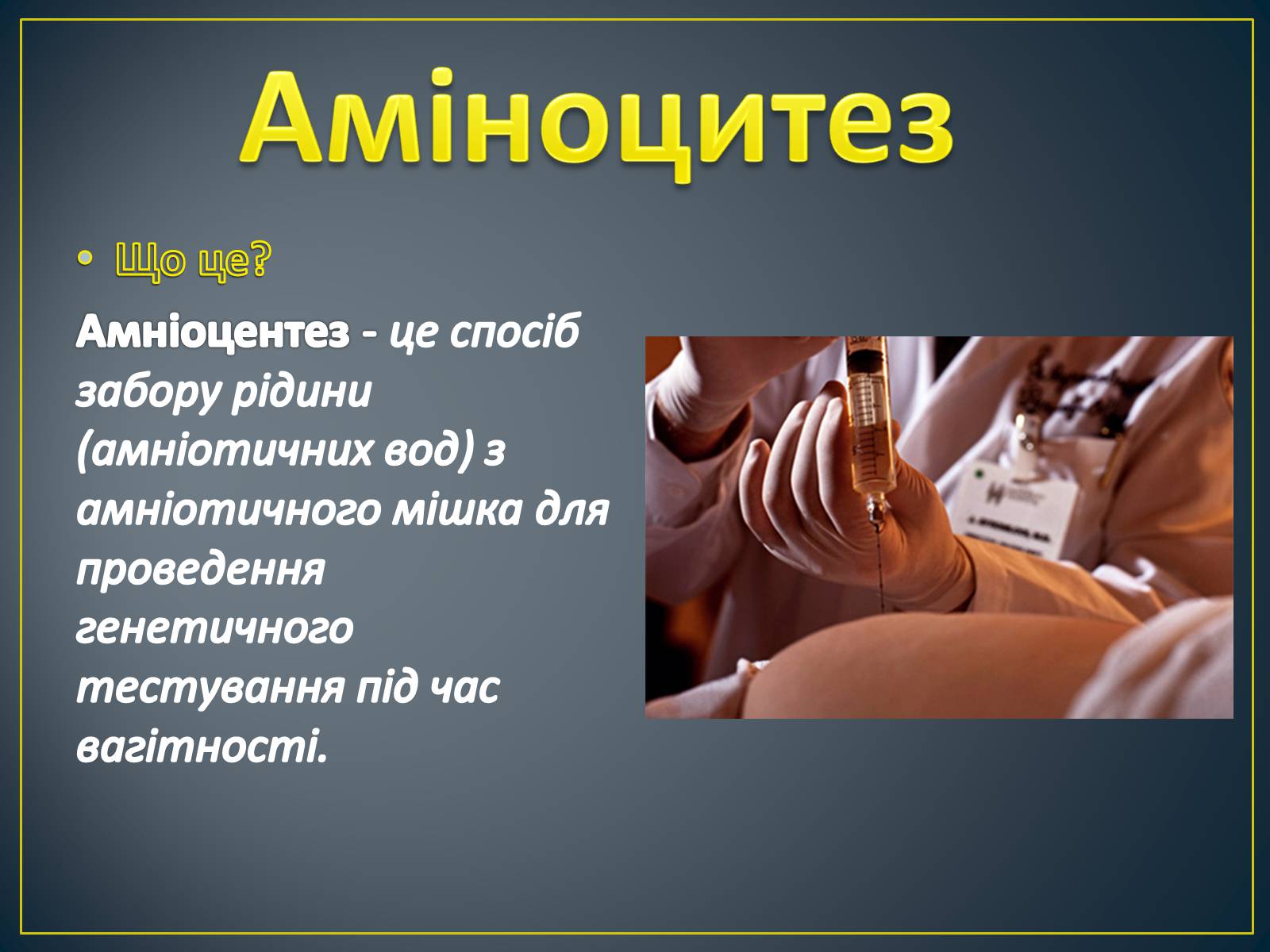 Презентація на тему «Типи генетичних хвороб людини» (варіант 2) - Слайд #23