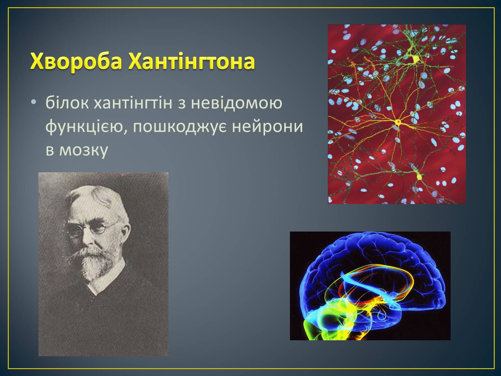 Презентація на тему «Типи генетичних хвороб людини» (варіант 2) - Слайд #5