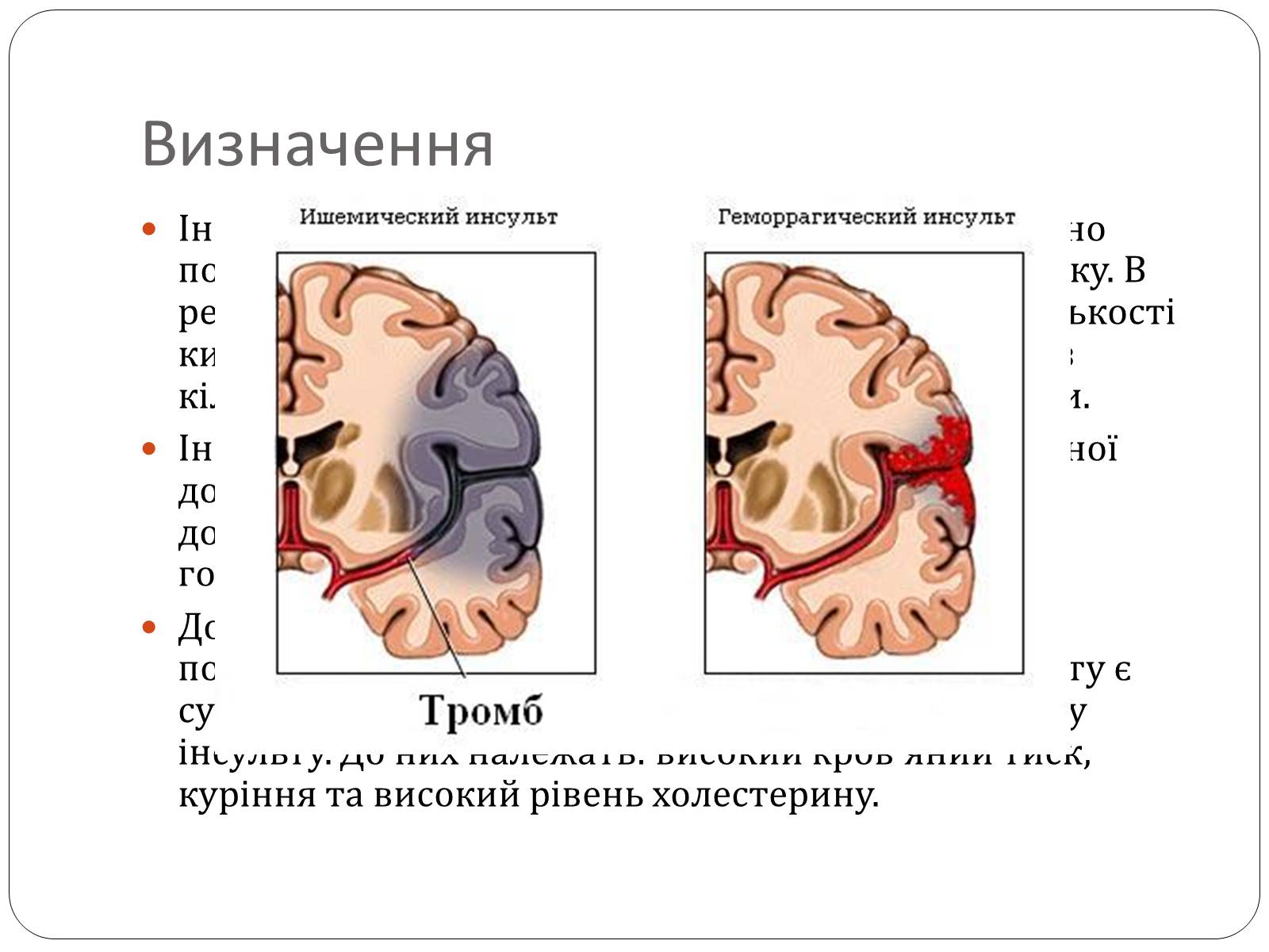 Презентація на тему «Інсульт» (варіант 2) - Слайд #3