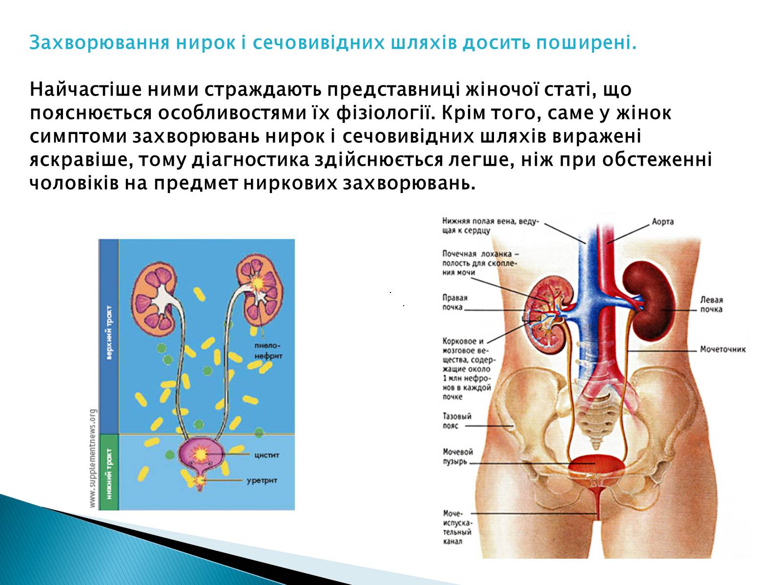 Презентація на тему «Захворювання нирок і сечовивідних шляхів» - Слайд #2