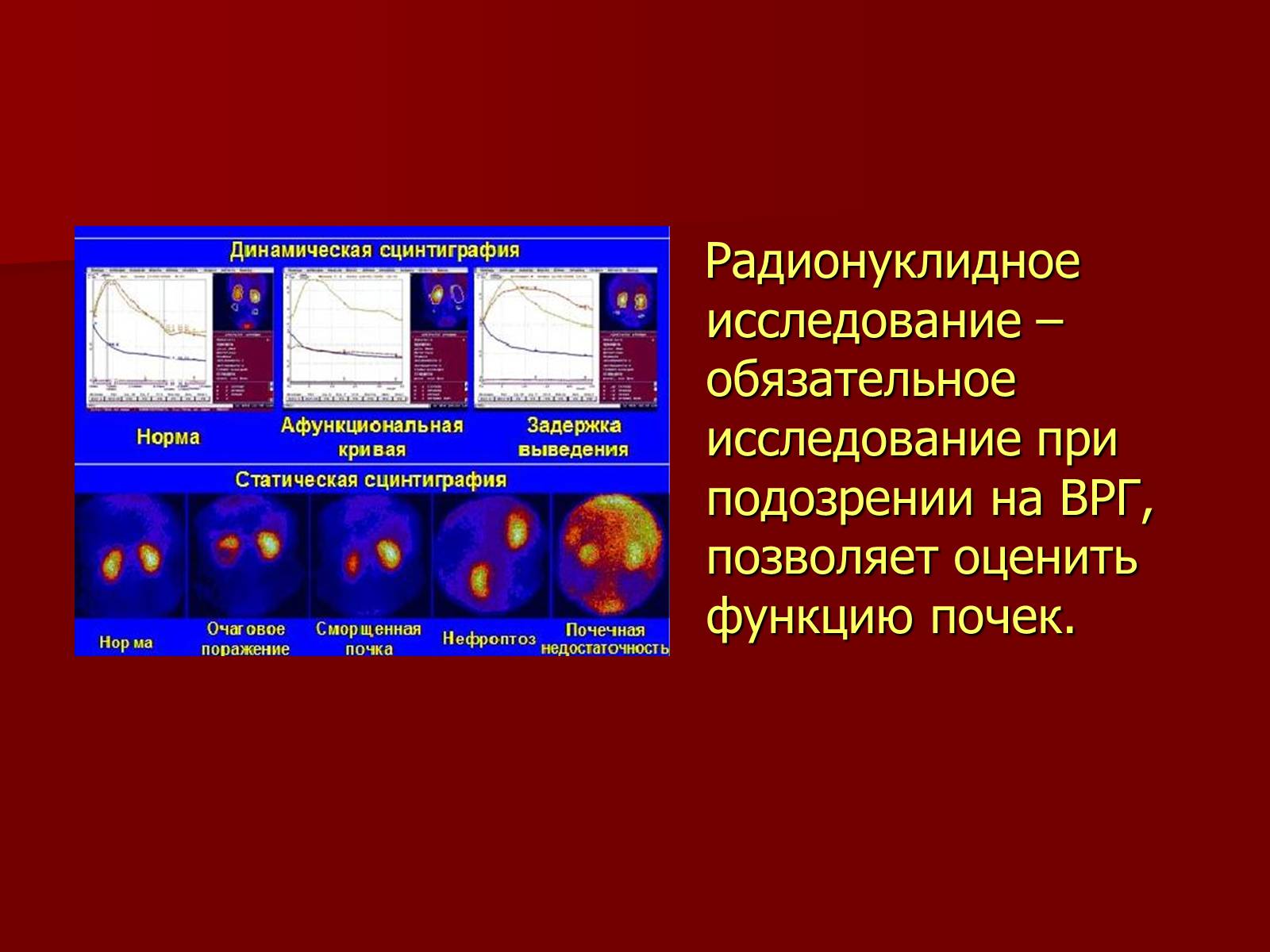 Презентація на тему «Вазоренальная гипертензия» - Слайд #11