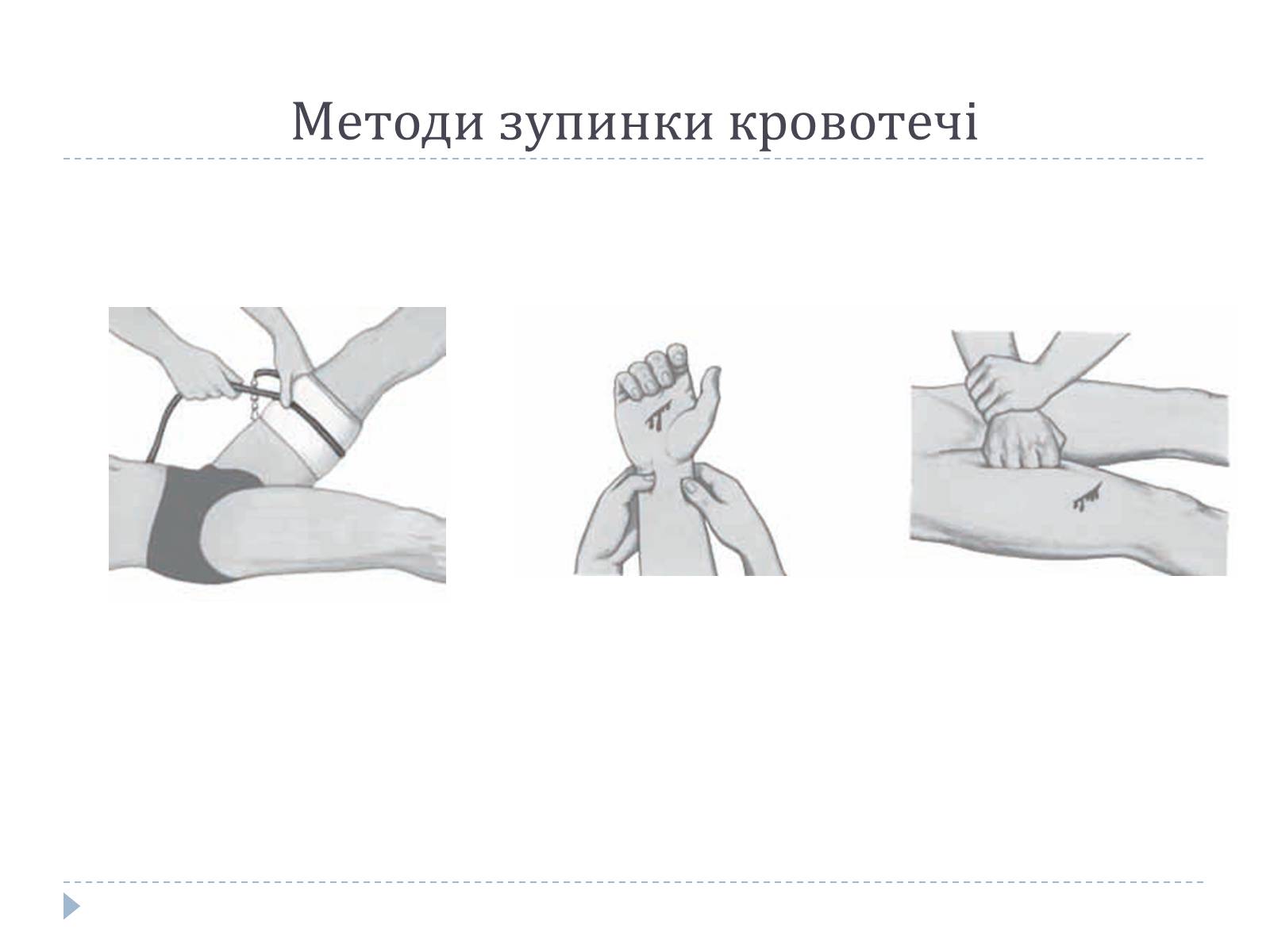 Презентація на тему «Перша допомога в разі травм і нещасних випадків» - Слайд #8