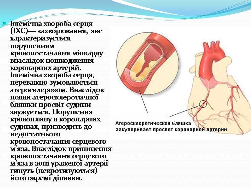 Презентація на тему «Найчастіші захвонювання людей» - Слайд #13