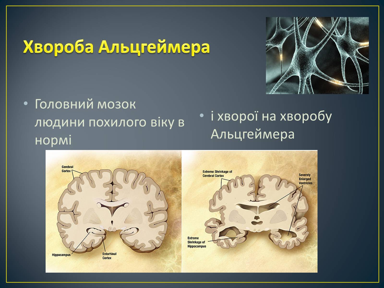 Презентація на тему «Типи генетичних хвороб людини» (варіант 3) - Слайд #12