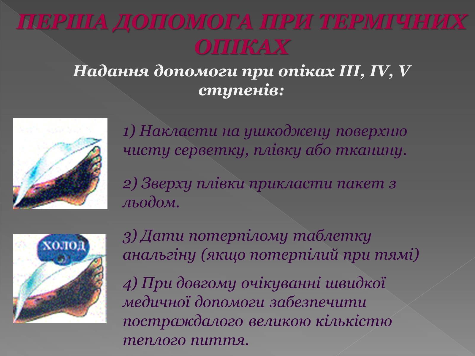 Презентація на тему «Опіки» (варіант 6) - Слайд #12