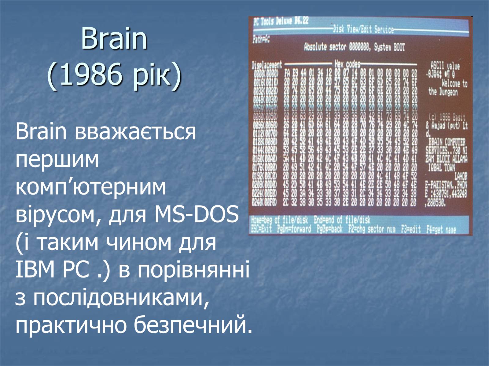 Презентація на тему «Цікаві комп&#8217;ютерні віруси» - Слайд #5