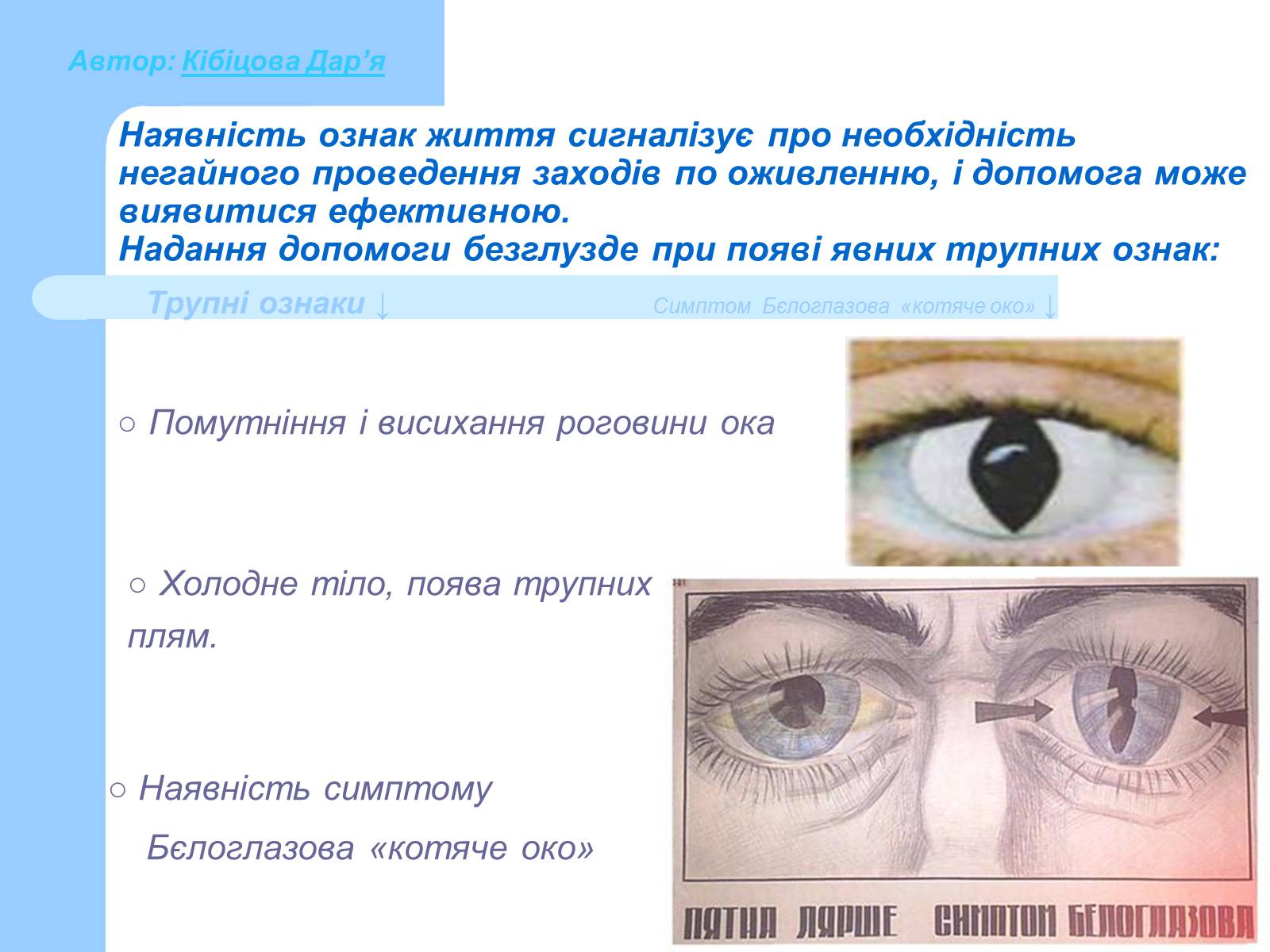 Презентація на тему «Основні принципи порятунку та захисту людей» - Слайд #6